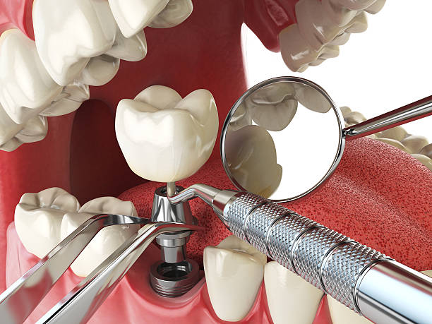 Best Emergency Treatment for Dental Infections or Abscesses in Mount Morris, MI